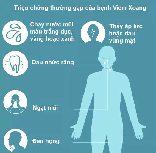 triệu chứng nhận biết bệnh xoang mũi